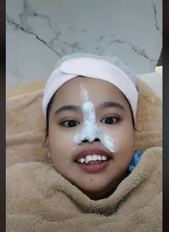 Potret Kekeyi Setelah Filler Hidung, Foto Before-After Viral