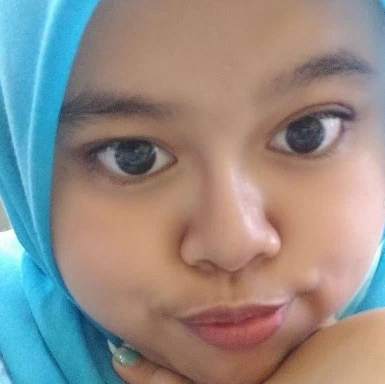Potret Kekeyi Setelah Filler Hidung, Foto Before-After Viral