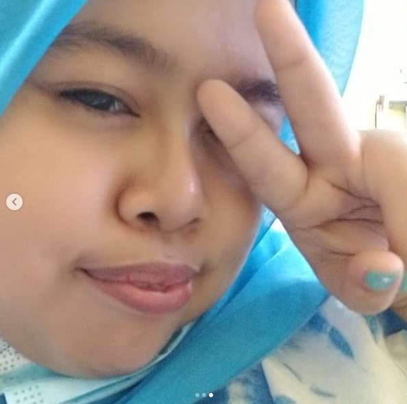 Potret Kekeyi Setelah Filler Hidung, Foto Before-After Viral