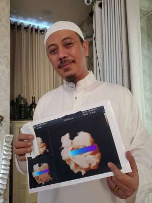 Momen Istri Opick, Bebi Silvana Melahirkan Bayi Laki-laki