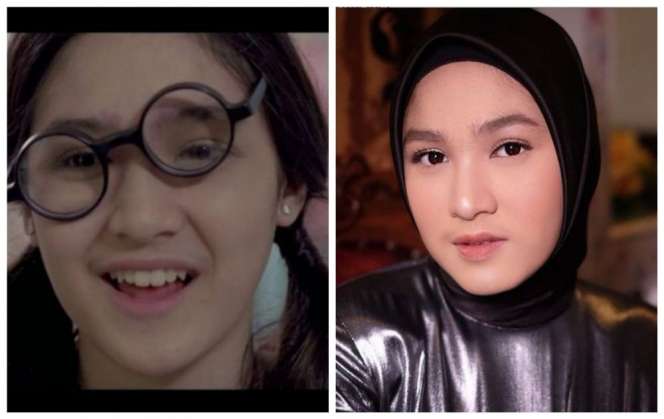 10 Artis Pemeran Tokoh Culun Ini Aslinya Modis dan Cakep Abis