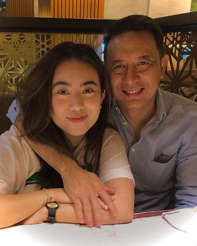 5 Pesona Casey Rebecca, Putri Semata Wayang Sonny Tulung