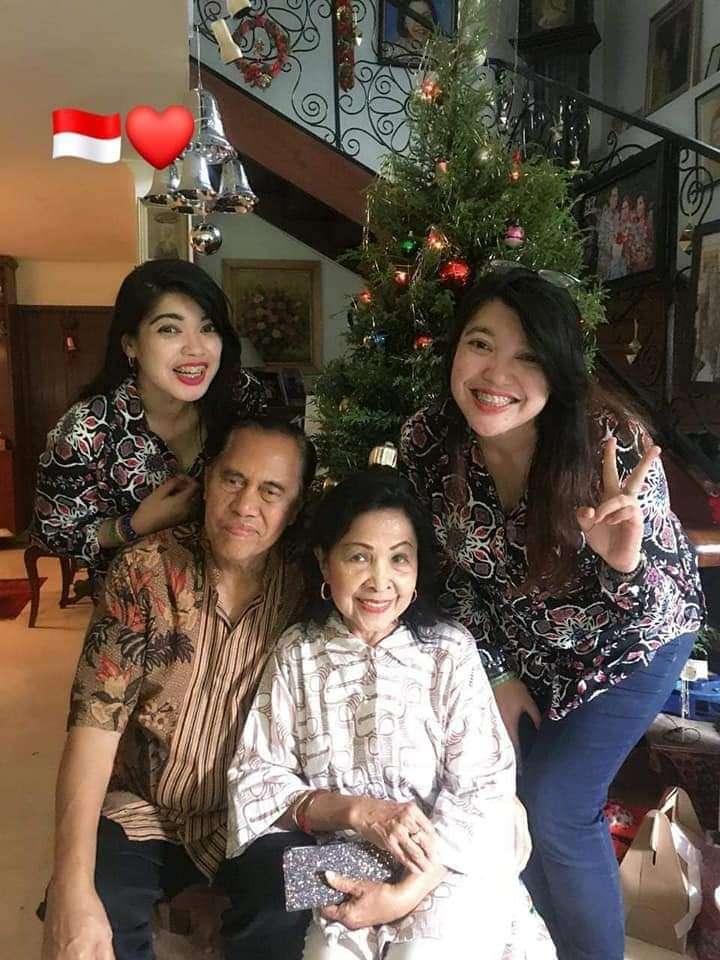 Kabar Bayi Kembar Siam Yuliana-Yuliani, Kini Jadi Orang Hebat