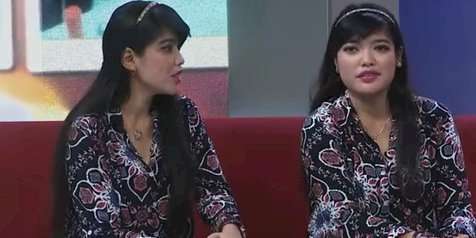 Kabar Bayi Kembar Siam Yuliana-Yuliani, Kini Jadi Orang Hebat