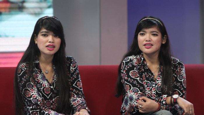 Kabar Bayi Kembar Siam Yuliana-Yuliani, Kini Jadi Orang Hebat