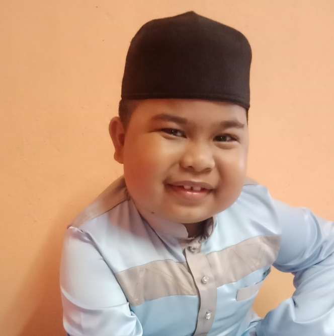 7 Foto Aming Tawau, Bocah yang Dulu Viral Kini Meninggal Dunia