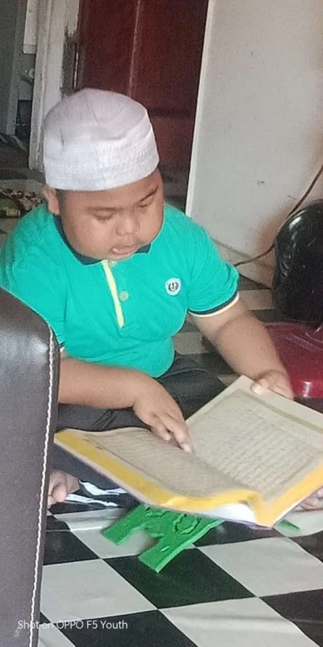 7 Foto Aming Tawau, Bocah yang Dulu Viral Kini Meninggal Dunia