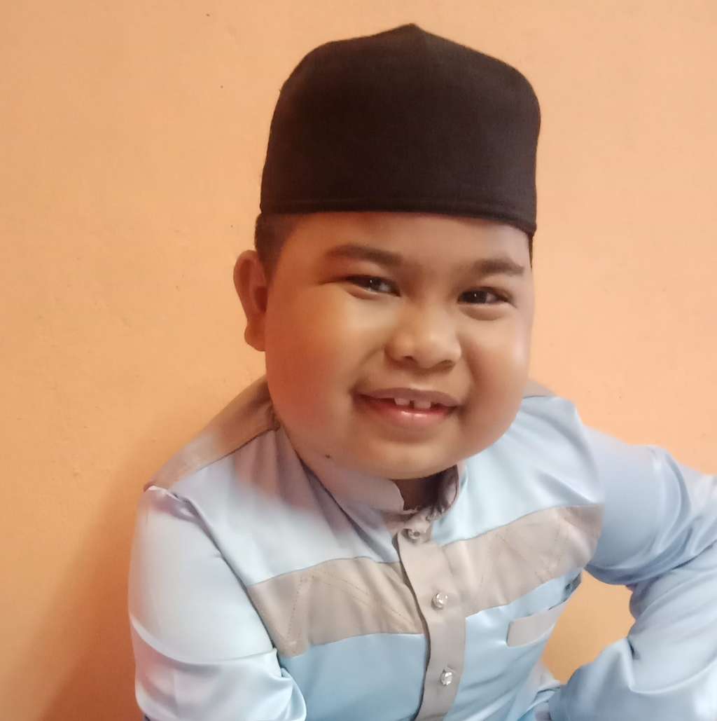7 Foto Aming Tawau, Bocah yang Dulu Viral Kini Meninggal Dunia