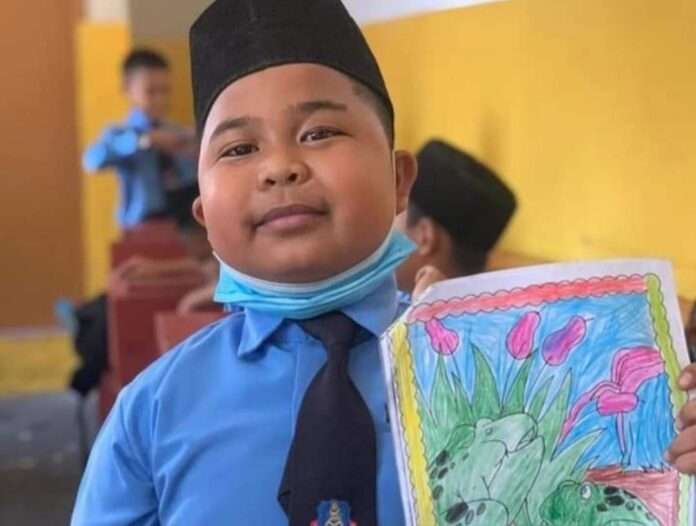 7 Foto Aming Tawau, Bocah yang Dulu Viral Kini Meninggal Dunia