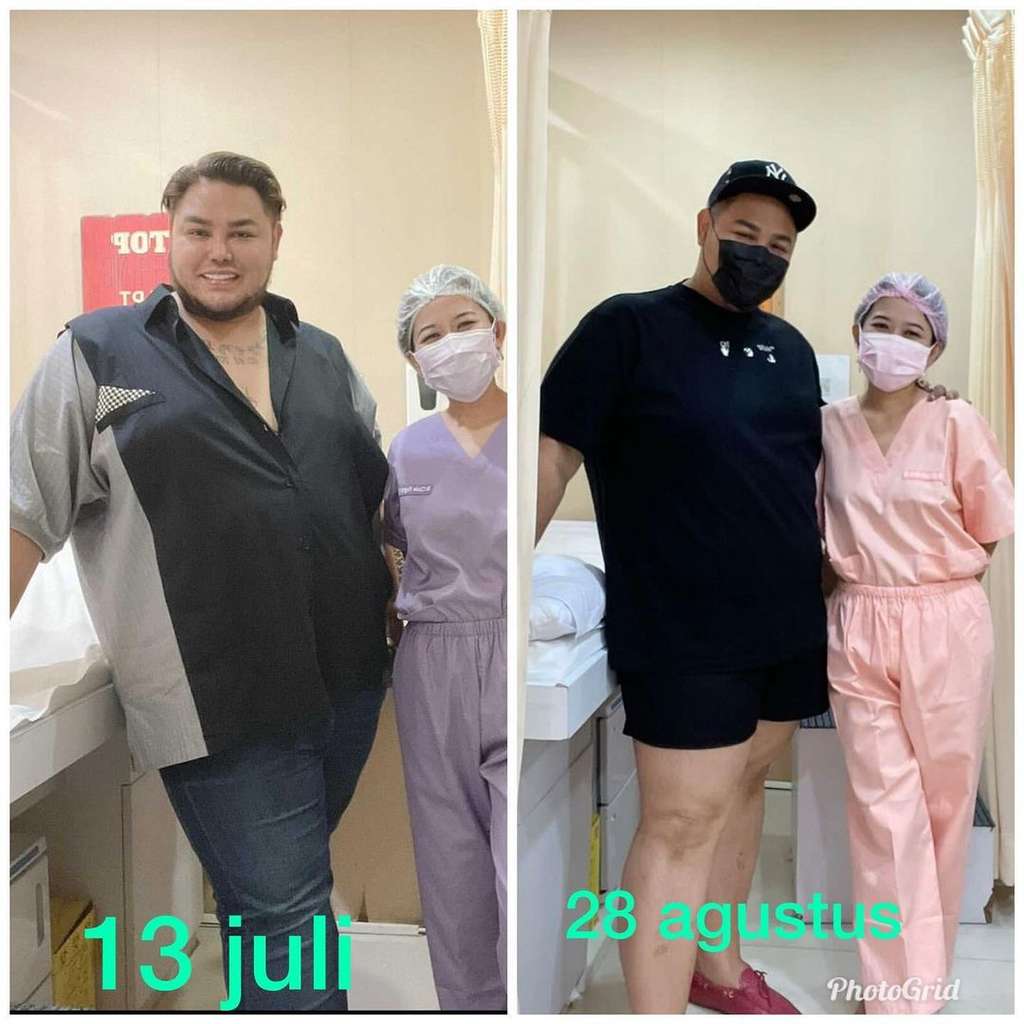 10 Foto Terbaru Ivan Gunawan usai Turun 18 Kilo, Bikin Takjub!