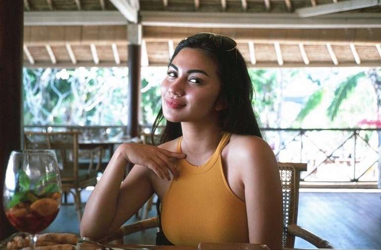 7 Seleb Cantik Pejuang Jerawat, Ada yang Sampai Parah Banget!