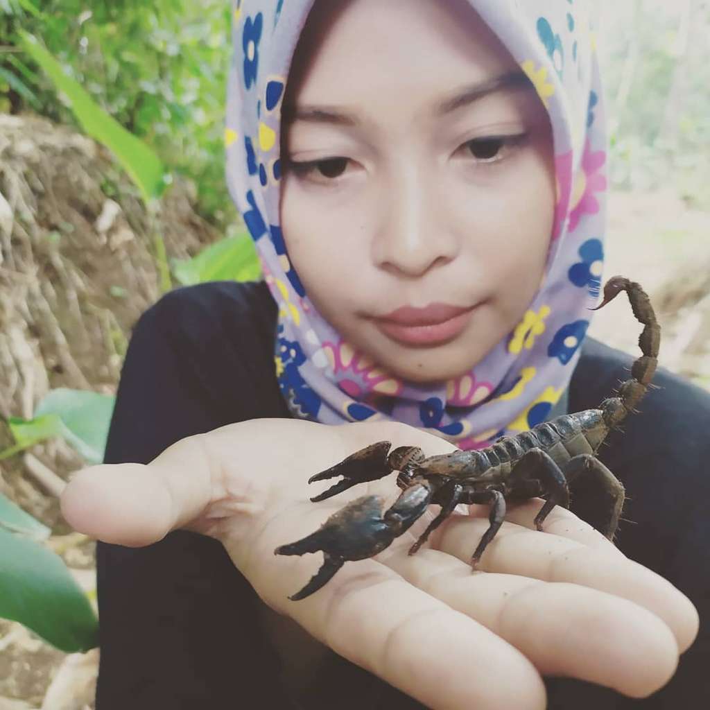 Ingat Gadis yang Dagunya Digigit Ular? Gini Nasibnya Sekarang