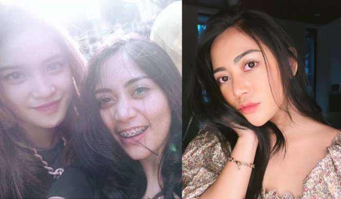 8 Gaya Rachel Vennya Dulu Vs Kini, Perubahannya Bikin Melongo!