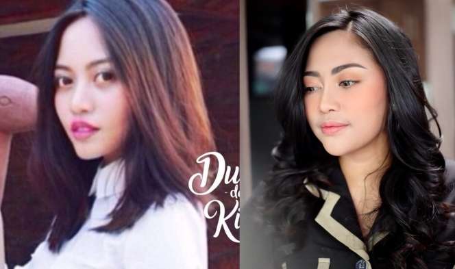 8 Gaya Rachel Vennya Dulu Vs Kini, Perubahannya Bikin Melongo!
