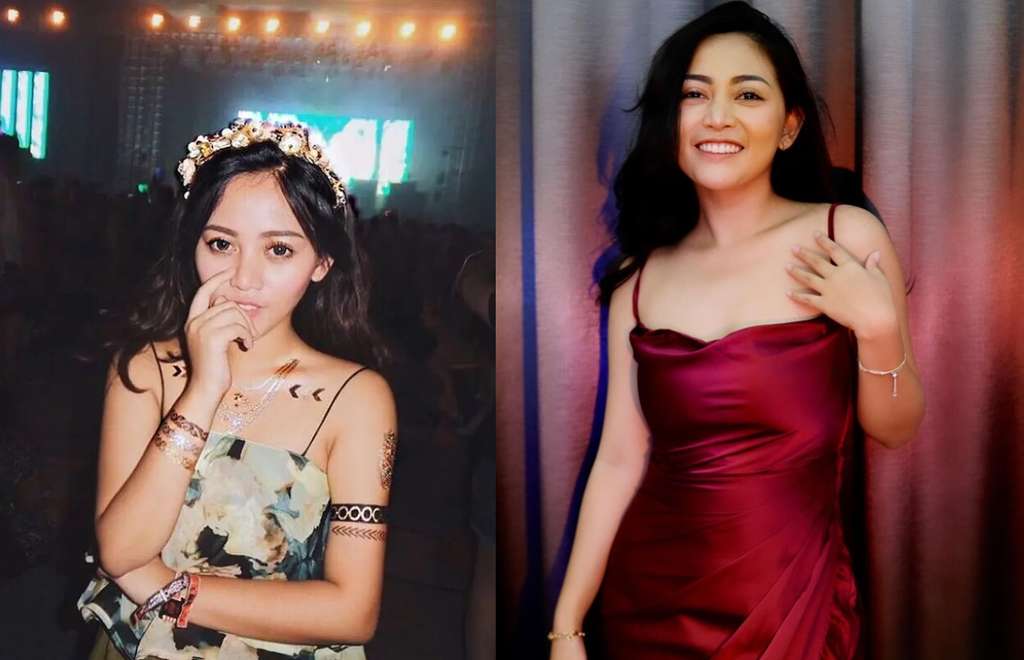 8 Gaya Rachel Vennya Dulu Vs Kini, Perubahannya Bikin Melongo!