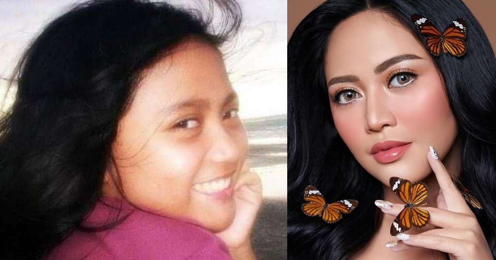 8 Gaya Rachel Vennya Dulu Vs Kini, Perubahannya Bikin Melongo!