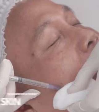 5 Perawatan yang Dilakukan Ayah Rozak, Jadi Makin Glowing