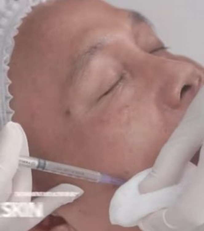 5 Perawatan yang Dilakukan Ayah Rozak, Jadi Makin Glowing