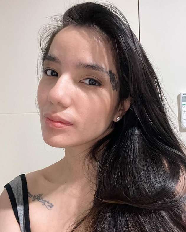 Sheila Marcia Hapus Tato, Pamer Bekas Luka di Tubuh