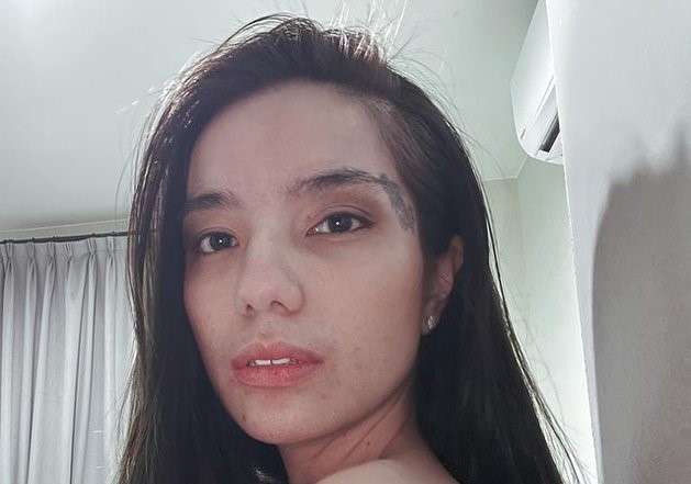 Sheila Marcia Hapus Tato, Pamer Bekas Luka di Tubuh