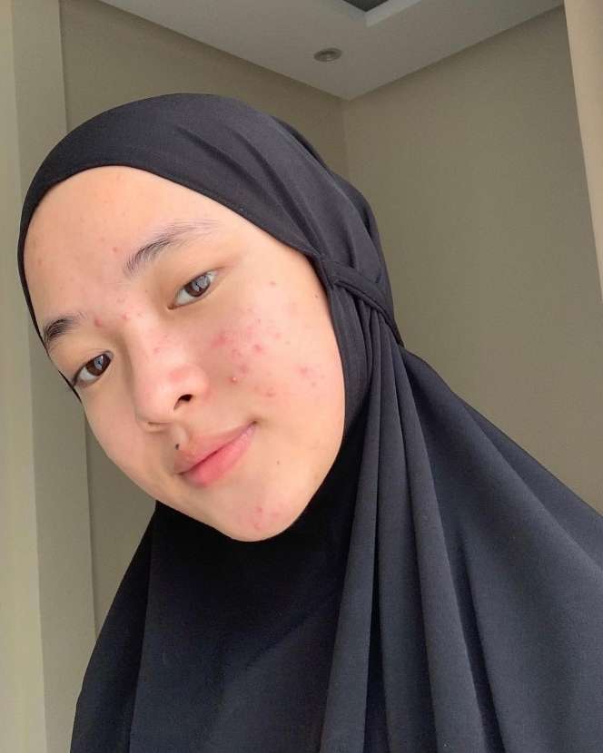 Sempat Jerawatan, Ini 8 Potret Nissa Sabyan dengan Wajah Mulus Tampil Polos