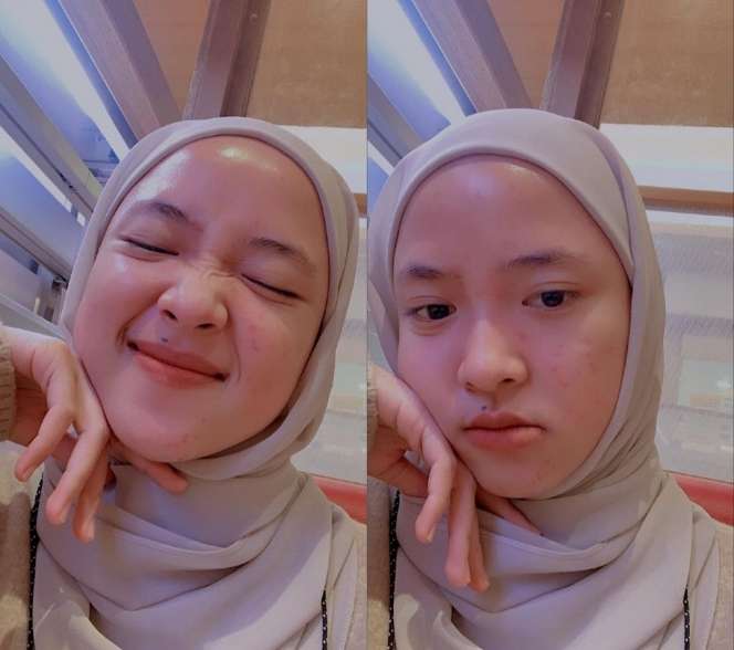 Sempat Jerawatan, Ini 8 Potret Nissa Sabyan dengan Wajah Mulus Tampil Polos