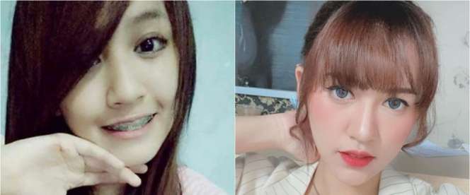 8 Potret Dulu vs Kini Biduan Koplo Happy Asmara, Perubahannya Drastis Banget!