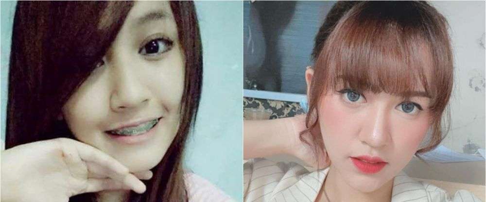 8 Potret Dulu vs Kini Biduan Koplo Happy Asmara, Perubahannya Drastis Banget!