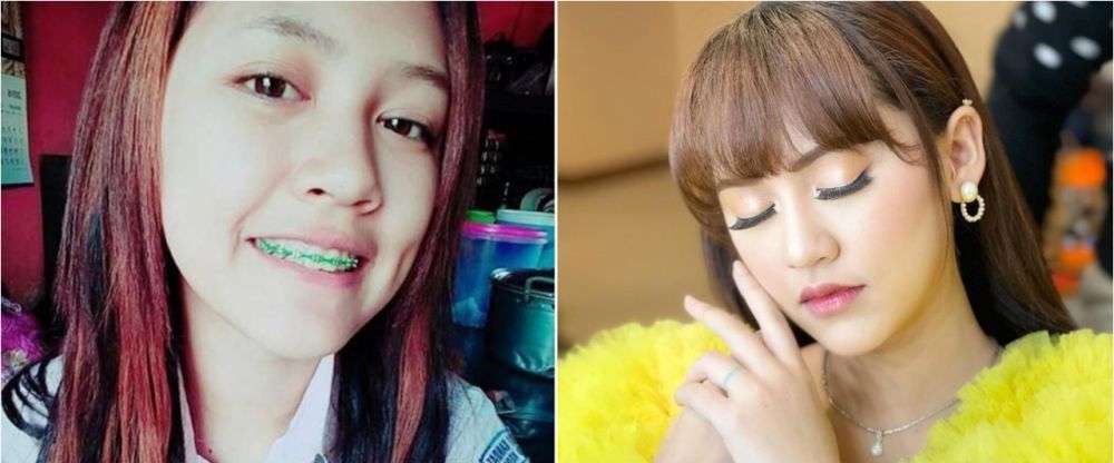 8 Potret Dulu vs Kini Biduan Koplo Happy Asmara, Perubahannya Drastis Banget!
