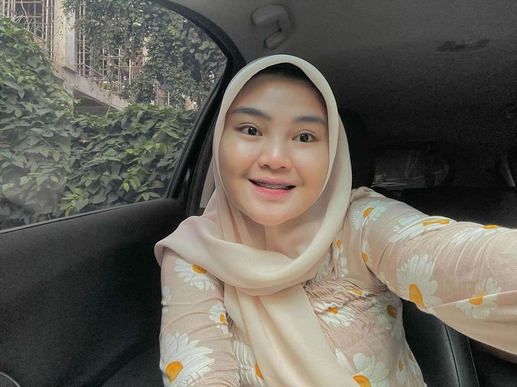 Ingat Rosa Meldianti, Keponakan Dewi Perssik? Dulu Dibully, Kini Penampilannya Beda Banget!