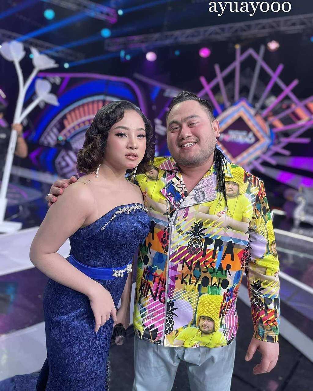 9 Foto Cantiknya Findi Artika, Biduan 19 Tahun Kekasih Baru Nassar