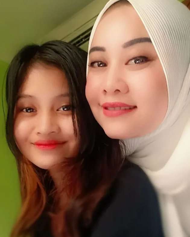8 Potret Nachika Septalia Adik Sambung Vanessa Angel, Dulu Dibilang Mirip Kini Dihujat!