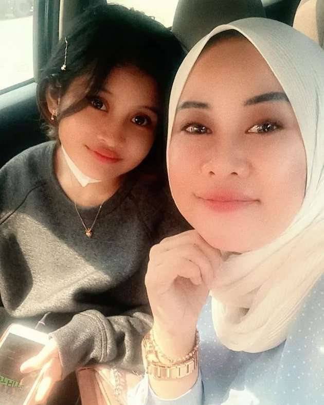 8 Potret Nachika Septalia Adik Sambung Vanessa Angel, Dulu Dibilang Mirip Kini Dihujat!