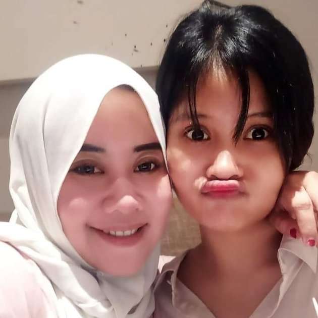 8 Potret Nachika Septalia Adik Sambung Vanessa Angel, Dulu Dibilang Mirip Kini Dihujat!