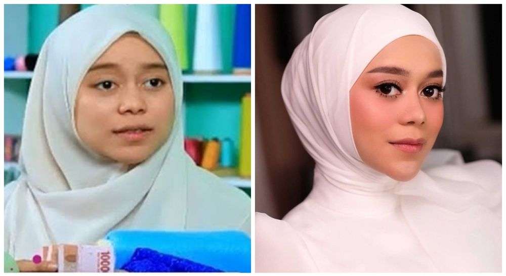Potret 11 Penyanyi Sebelum Vs Sesudah Tanam Benang, Lesty Kejora Beda Banget!