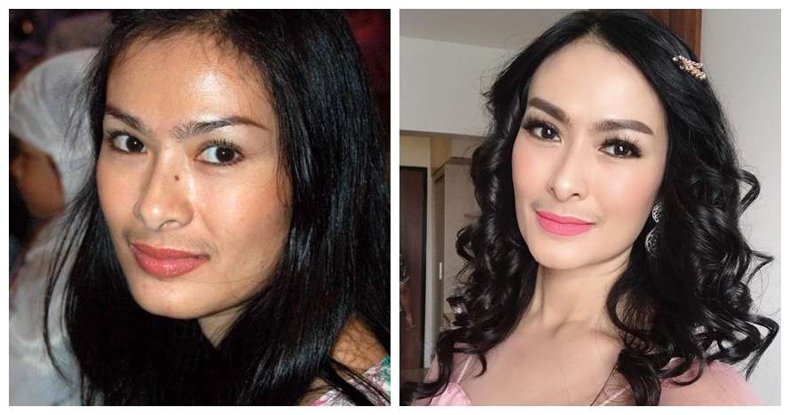 Potret 11 Penyanyi Sebelum Vs Sesudah Tanam Benang, Lesty Kejora Beda Banget!
