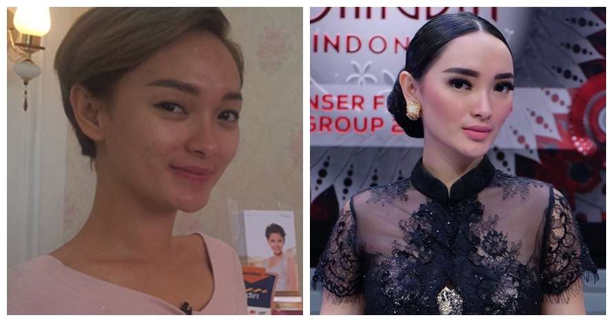 Potret 11 Penyanyi Sebelum Vs Sesudah Tanam Benang, Lesty Kejora Beda Banget!