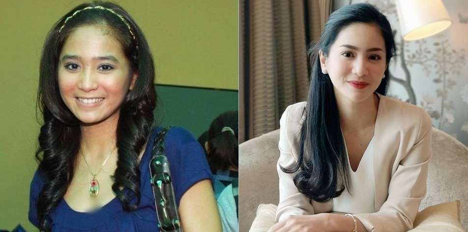 Wajahnya Berubah Drastis, 9 Artis Ini Malah Dituduh Jalani Operasi Plastik, Tina Toon Bikin Melongo!