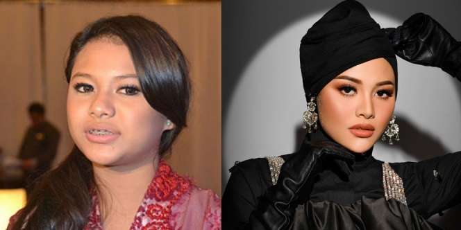 Wajahnya Berubah Drastis, 9 Artis Ini Malah Dituduh Jalani Operasi Plastik, Tina Toon Bikin Melongo!