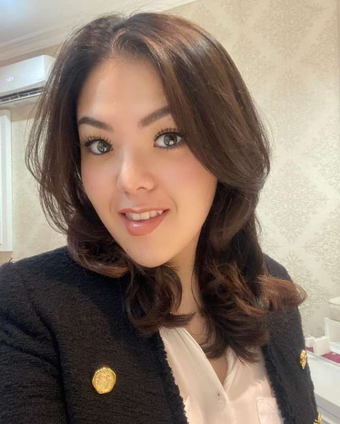 9 Foto Perubahan Wajah Tina Toon Yang Bikin Geger, Berubah Drastis Sampai Dibilang Oplas!