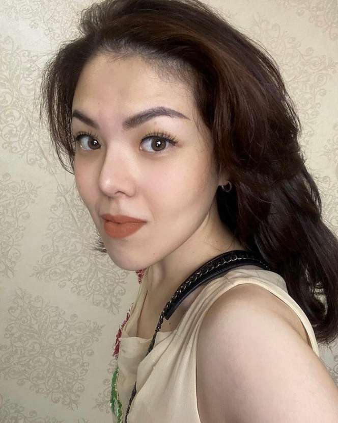 9 Foto Perubahan Wajah Tina Toon Yang Bikin Geger, Berubah Drastis Sampai Dibilang Oplas!