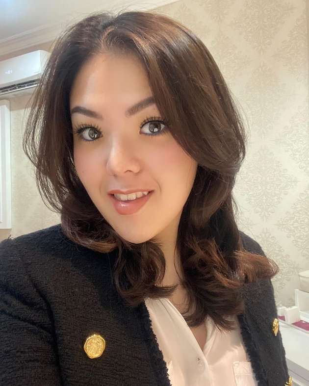 9 Foto Perubahan Wajah Tina Toon Yang Bikin Geger, Berubah Drastis Sampai Dibilang Oplas!