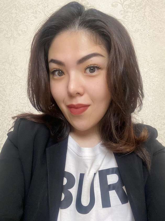 9 Foto Perubahan Wajah Tina Toon Yang Bikin Geger, Berubah Drastis Sampai Dibilang Oplas!