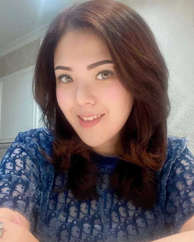 9 Foto Perubahan Wajah Tina Toon Yang Bikin Geger, Berubah Drastis Sampai Dibilang Oplas!