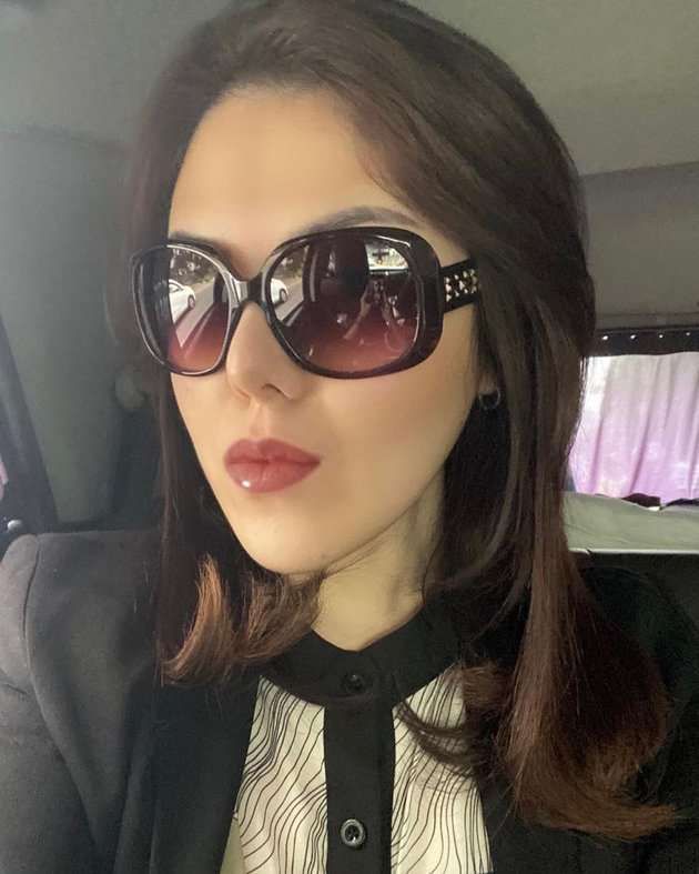 Potret Terbaru Tina Toon yang Diduga Oplas, Dagu dan Hidung Bikin Salfok!