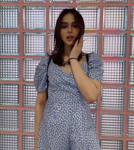 6 Potret Laura Anna, Manta Kekasih Gaga yang Lumpuh Akibat Kecelakaan