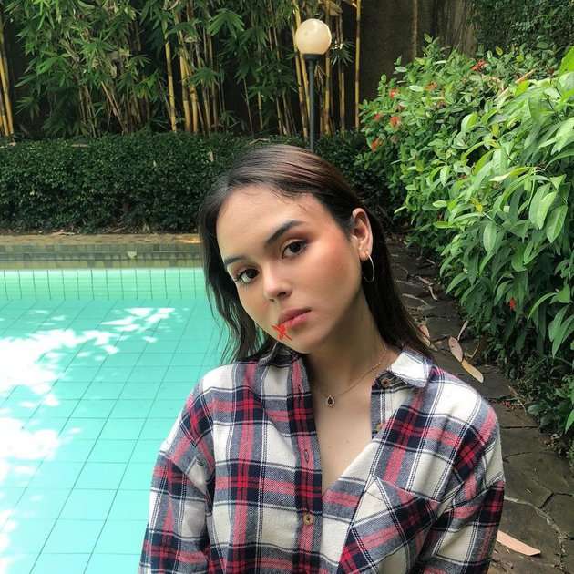 6 Potret Laura Anna, Manta Kekasih Gaga yang Lumpuh Akibat Kecelakaan