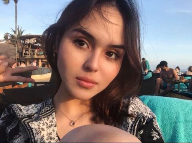 6 Potret Laura Anna, Manta Kekasih Gaga yang Lumpuh Akibat Kecelakaan