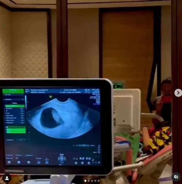 7 Potret Dea Ananda Hamil Anak Pertama, Penantian 12 Tahun Terbayar!