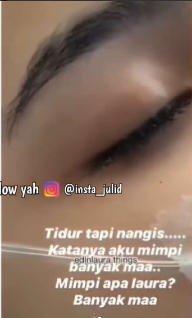 Potret Laura Anna Menangis dalam Tidurnya Usai Kecelakaan